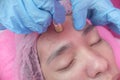 An Esthetician performs a Diamond peel facial, a type of microdermabrasion procedure. Exfoliating the forehead and face. At a