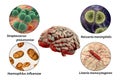 Etiology of bacterial meningitis Royalty Free Stock Photo