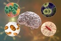 Etiology of bacterial meningitis Royalty Free Stock Photo