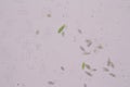 Euglena is a genus of single-celled flagellate Eukaryotes under microscopic.