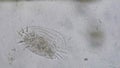 Euplotes in brackish water sample