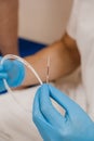 EVLT Red laser optical fiber for endovenous laser coagulation. Endovenous laser treatment treats varicose veins using an Royalty Free Stock Photo