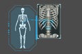 Examines a technological digital holographic plate representing the patient\'s body, Fracture lumbar Concept: Futuristic