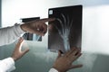 Examining the x ray of two hands Medical check at the shoulder in a physiotherapy center