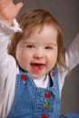 Excited handicapped toddler Royalty Free Stock Photo
