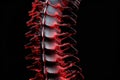 Excruciating Spine pain. Generate Ai