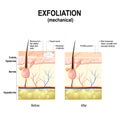 Exfoliation or peel is cosmetic procedures Royalty Free Stock Photo