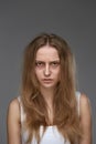 Exhausted Young Woman With Bruises Under Eyes Royalty Free Stock Photo