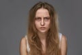 Exhausted Young Woman With Bruises Under Eyes Royalty Free Stock Photo
