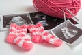 Expecting baby concept. Ultrasound pictures and knitting shoes