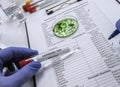 Expert analyzes stuffed meat contaminated by bacterium of listeria in laboratory