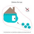 Explanation of the disease diabetes first type of diabetes in children's pictures