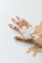 Exploring skin tone diversity through minimalist artwork showcasing vitiligo details Royalty Free Stock Photo