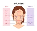 Expression wrinkles and Aging wrinkles ( female face ) vector illustration / Japanese Royalty Free Stock Photo