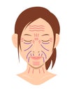Expression wrinkles and Aging wrinkles ( female face ) vector illustration / no text Royalty Free Stock Photo