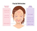 Expression wrinkles and Aging wrinkles ( female face ) vector illustration Royalty Free Stock Photo