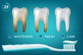 Extra Whitening Toothpaste Healthy Teeth Concept. Vector Realistic Set Illustration 3d Extruded Toothpaste, Brandname Royalty Free Stock Photo