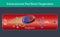 Extracorporeal Red Blood Oxygenation. Illustration