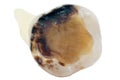 Extracted caries tooth isolated