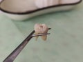 Extracted molar tooth in tweezers against the background of the dental tray