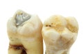 Extracted teeth with details on white background
