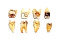 Extracted teeth on a white background