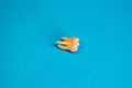 Extracted wisdom tooth on blue background, close-up