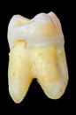 Extracted wisdom tooth isolated on black background