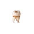 Extracted wisdom tooth