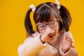 Extraordinary little girl with down syndrome having unusual face features