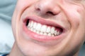 Extreme close up of human male mouth showing teeth.