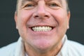 Extreme close up of a man\'s smile with large teeth