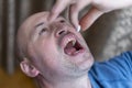 Extreme closeup man face taking white pill, mouth view swallowing pills, illness. man take medicine,open mouth and bring