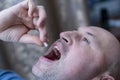 Extreme closeup man face taking white pill, mouth view swallowing pills, illness. man take medicine,open mouth and bring