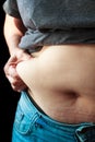 Extremely obese womans belly.