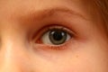 Eye of a child