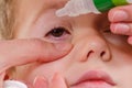 Eye child allergy and conjunctivitis red allergic, medicine
