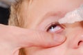 Eye child allergy and conjunctivitis red allergic, pollen
