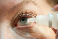 Eye with conjunctivitis is instilled with therapeutic drops