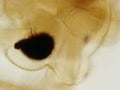 Cotton worm Eye 400x Magnification