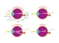 Eye defects. Normal vision, Hyperopia, Myopia.