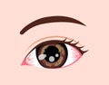 Eye disease vector illustration / Herpetic keratitis