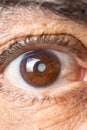 Eye of an elderly man with cataracts, clouding of the lens, macro. Royalty Free Stock Photo