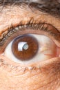 Eye of an elderly man with cataracts, clouding of the lens, macro. Royalty Free Stock Photo