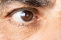 Eye of an elderly man with cataracts, clouding of the lens, macro. Royalty Free Stock Photo