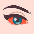 Disorder of eyes, Sore eyes, inflamed reddened eyes, red eyes icon. Vector illustration