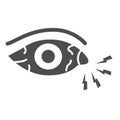 Eye pain and infection solid icon, illness and injury concept, Sore eyes sign on white background, Redness of eyes icon