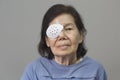 Eye shield covering after cataract surgery. Royalty Free Stock Photo