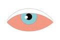 Eye sore line icon, disease and allergy, eye redness vector icon, vector graphics