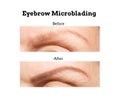 Eyebrow Microblading Before and After